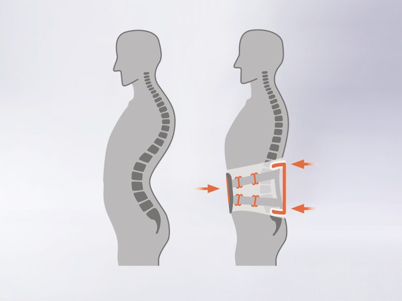 VERTEBRADYN® FORCE